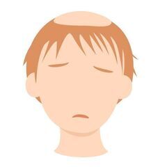 【薄毛でお困りの方】AGA・ハゲでお悩みの方