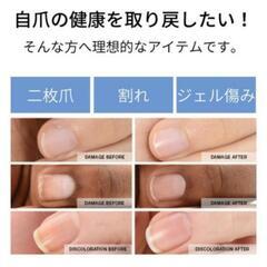 深爪　二枚爪　ネイルケアの画像