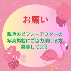 脱毛モニター募集