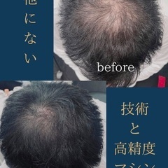 薄毛のお悩み【即日解消】