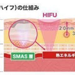 【市ヶ谷】★ハイフで小顔に★￥6,000女性限定モニター募集 - 千代田区