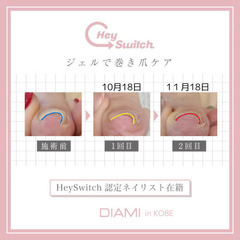 巻き爪ケアセミナー受講者募集❗の画像