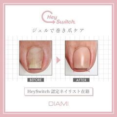 巻き爪ケアセミナー受講者募集❗の画像