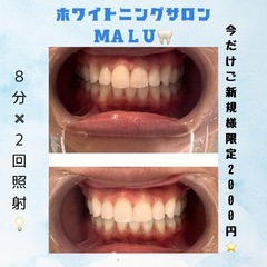 ホワイトニングサロンMALU🦷