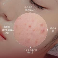 VTアゼライン酸 トナーパッド 60枚入の画像