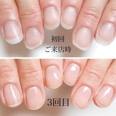 限定7名様！自爪育成モニター募集 - 佐倉市