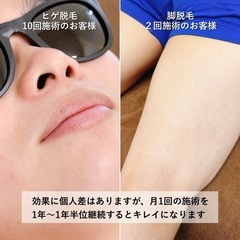 🌸開店１周年！先着50名様にノベルティプレゼント🎁 - ボディケア