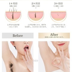 新品未使用　脱毛器 低温サファイア冷却 速い 痛くない 軽量 vio対応 99万発　顔 無痛の画像