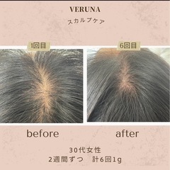 薄毛、美髪ケア！スカルプトゲケアモニター様募集🌿✨ - ボディケア