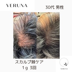 薄毛、美髪ケア！スカルプトゲケアモニター様募集🌿✨ − 大阪府
