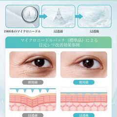 目元パック ヒアルロン酸パッチ の画像