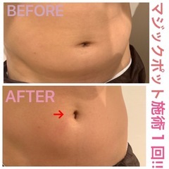 夏までに痩せたい！痩身モニター募集の画像
