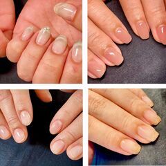 爪が割れる⚡️二枚爪⚡️爪の凹凸⚡️爪の形などお悩みの方💅