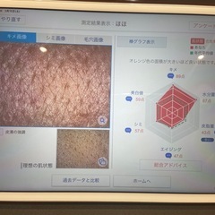特殊なカメラで肌チェック😳 - その他