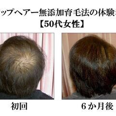 抜け毛、薄毛でお悩みの方へ！毛髪相談６０分初回無料！マイクロスコ...