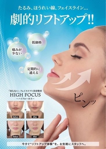 ハイフ/ハイフォーカス/レピラスリフト ハイフ/ハイフォーカス/レピラスリフト