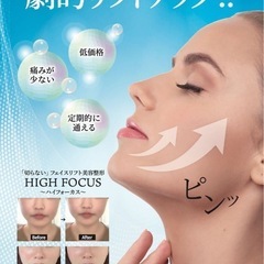 ハイフ/ハイフォーカス/レピラスリフトの画像