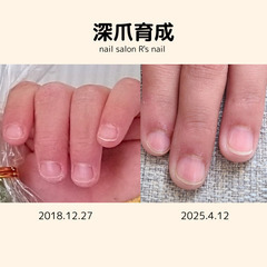 深爪育成✋