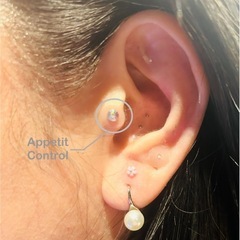 耳つぼ1Day講座の画像