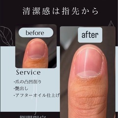 新しいスタッフが施術するメンズ爪ケア - 名古屋市