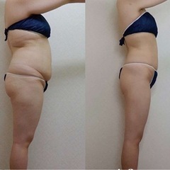 2週間集中 ダイエット オンライン指導可