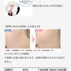 子供ok！脱毛器の画像