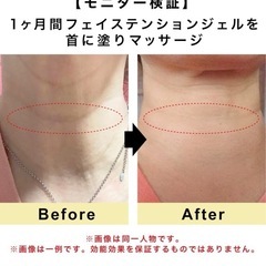 残2本！【新品未開封】お顔疲れに EntreX フェイステンションジェル 顔用マッサージジェルの画像