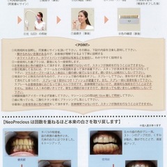 ホワイトニングマシーンの画像