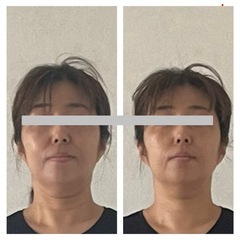 頭整体、小顔のモニター募集の画像