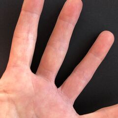 かゆ～い手疹は、さようなら出来る!の画像