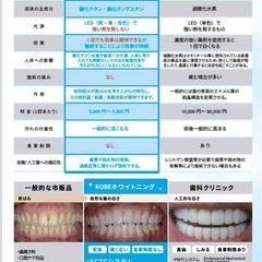 ホワイトニング機器レンタルの画像