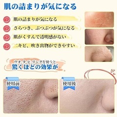 新品未使用　超音波洗顔器　フェイスケア　毛穴掃除の画像