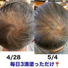 🌟再生美容🌟体験しませんか🎶✨ 塗るだけで凄いを体験❣️