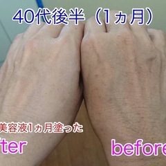 🌟頭皮のたるみを解消❣️✨ 塗るだけで凄いを体験✨ - 地元のお店