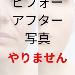 【マイナス5歳肌へ】たるみ/むくみ改善・ほうれい線には美容…