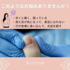 地元で安心♪巻き爪ケアサロンで痛みを改善💡