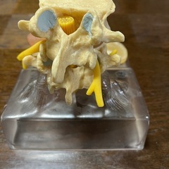 椎間板ヘルニア腰椎モデル。の画像
