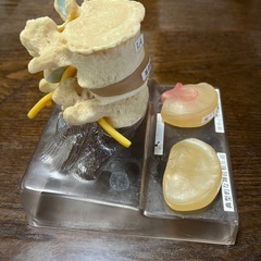 椎間板ヘルニア腰椎モデル。の画像