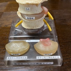 椎間板ヘルニア腰椎モデル。
