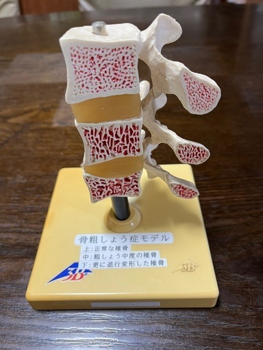 骨粗鬆症モデル