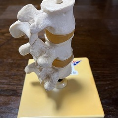 骨粗鬆症モデルの画像