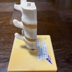 骨粗鬆症モデルの画像
