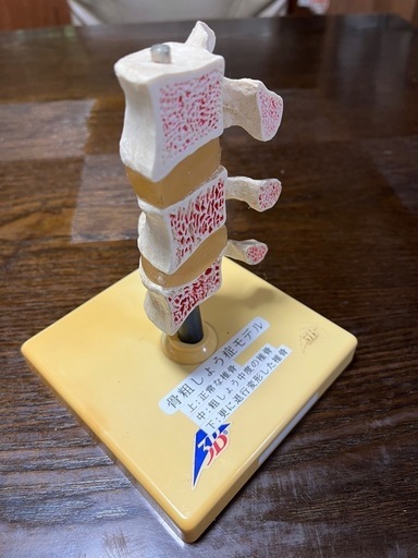 骨粗鬆症モデル