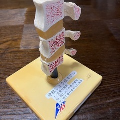 骨粗鬆症モデルの画像