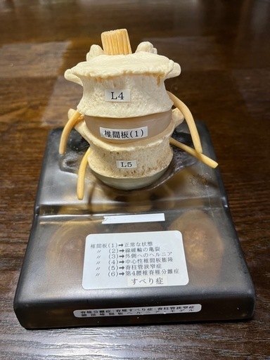脊椎椎間板ヘルニアモデル