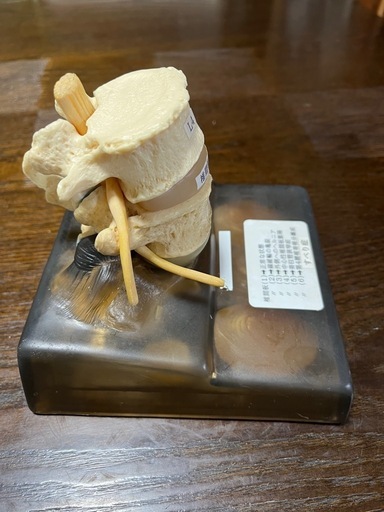脊椎椎間板ヘルニアモデル