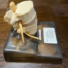 脊椎椎間板ヘルニアモデルの画像