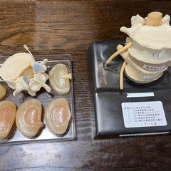脊椎椎間板ヘルニアモデルの画像