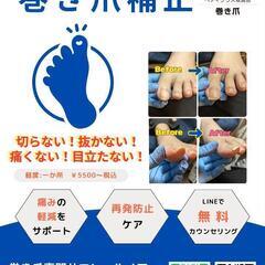 巻き爪のお悩み解決!痛くない巻き爪補正