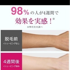 脱毛器 痛みが少ない 冷却 VIO対応 美肌 全身脱毛 照射回数無制限 剛毛の画像